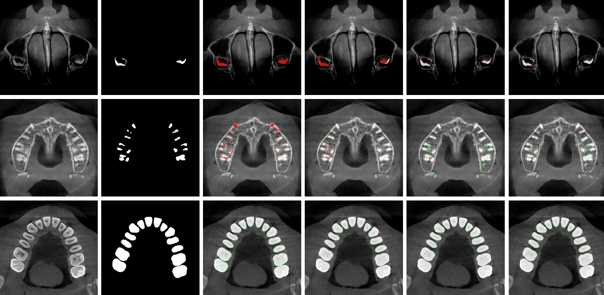 CBCT